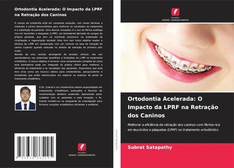 Ortodontia Acelerada: O Impacto da LPRF na Retração dos Caninos: Melhorar a eficiência da retração dos caninos com fibrina rica em leucócitos e plaquetas (LPRF) no tratamento ortodôntico