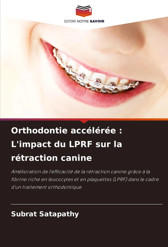 Orthodontie accélérée : L'impact du LPRF sur la rétraction canine