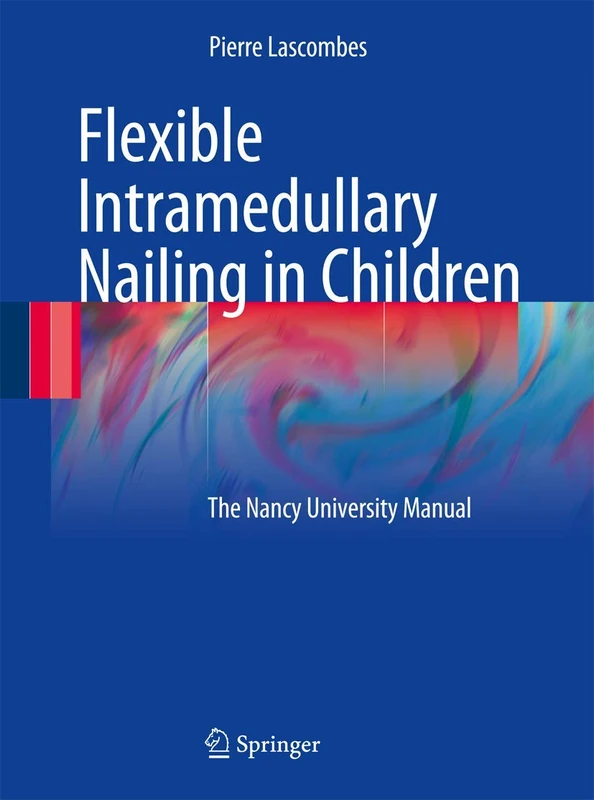 Flexible Intramedullary Nailing in Children: The Nancy University Manual