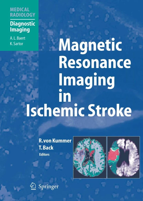 Magnetic Resonance Imaging in Ischemic Stroke (Medical Radiology)