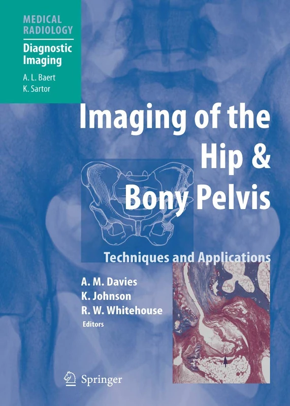 Springer - Imaging of the Hip & Bony Pelvis Textbook