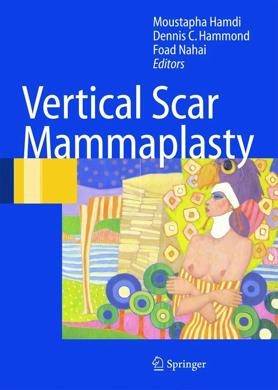 Springer - Vertical Scar Mammaplasty Medical Textbook