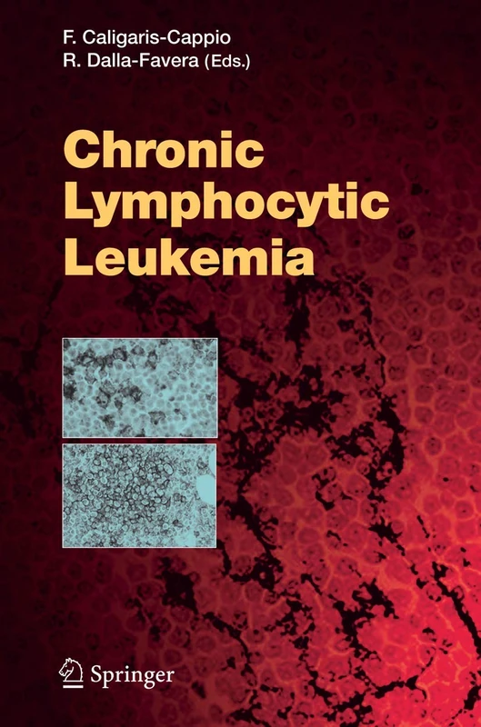 Chronic Lymphocytic Leukemia: 294 (Current Topics in Microbiology and Immunology, 294)