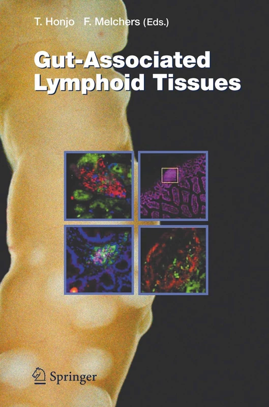 Gut-Associated Lymphoid Tissues: 308 (Current Topics in Microbiology and Immunology, 308) - Image 1