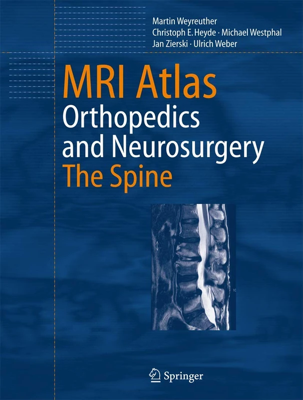 Springer MRI Atlas: Orthopedics and Neurosurgery, The Spine