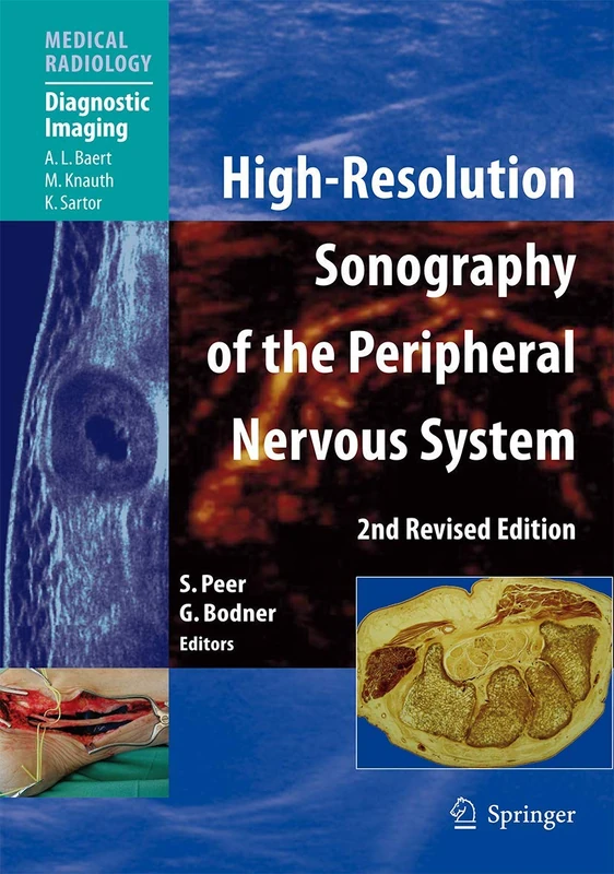 High-Resolution Sonography of the Peripheral Nervous System (Medical Radiology)