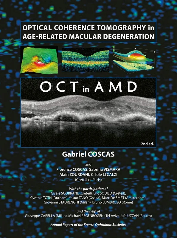 Optical Coherence Tomography in Age-Related Macular Degeneration (OCT in AMD)