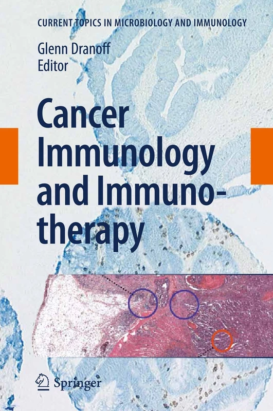 Cancer Immunology and Immunotherapy: 344 (Current Topics in Microbiology and Immunology, 344)