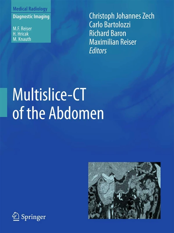 Multislice-CT of the Abdomen (Medical Radiology)