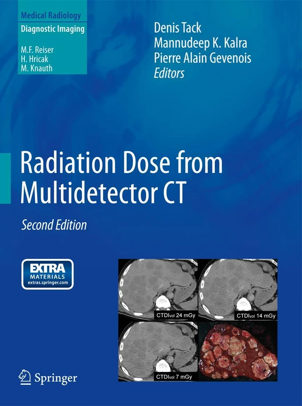 Radiation Dose from Multidetector CT (Medical Radiology)