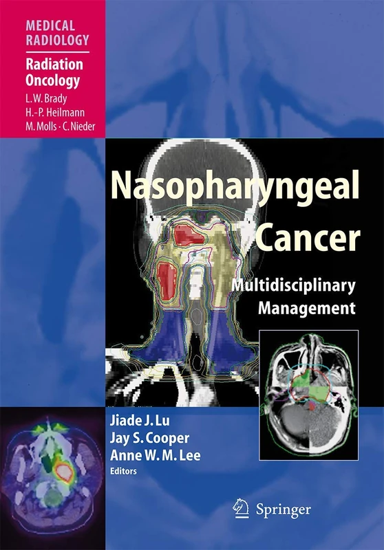 Nasopharyngeal Cancer: Multidisciplinary Management (Medical Radiology)