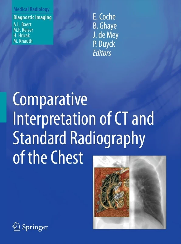 Comparative Interpretation of CT and Standard Radiography of the Chest (Medical Radiology)