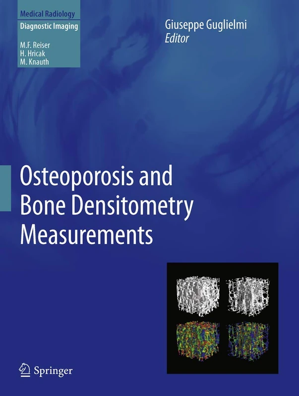 Springer Osteoporosis and Bone Densitometry Measurements Book