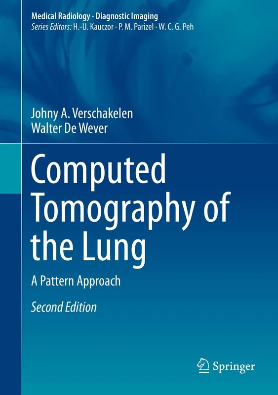 Computed Tomography of the Lung: A Pattern Approach (Medical Radiology)