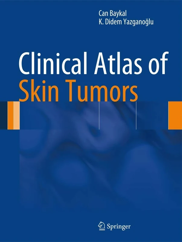 Clinical Atlas of Skin Tumors