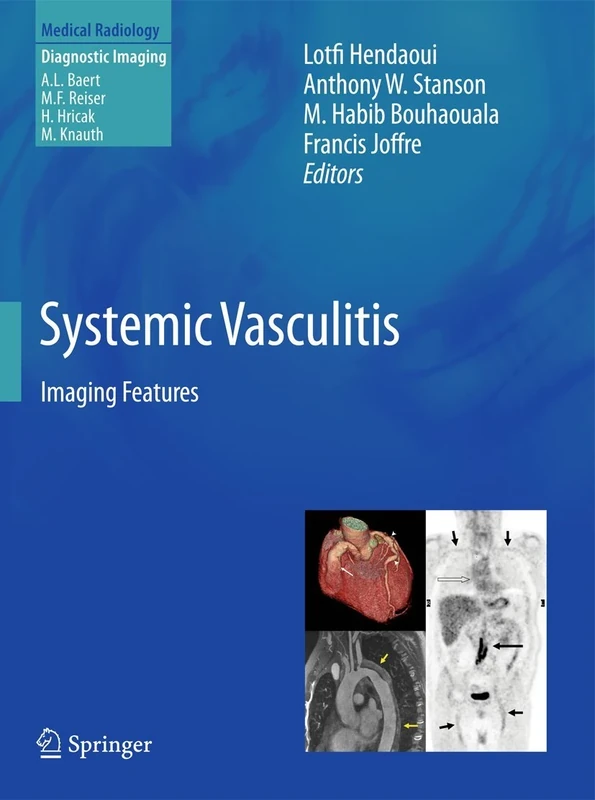 Systemic Vasculitis: Imaging Features (Medical Radiology)