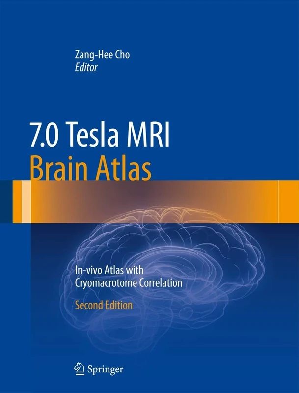7.0 Tesla MRI Brain Atlas: In-vivo Atlas with Cryomacrotome Correlation