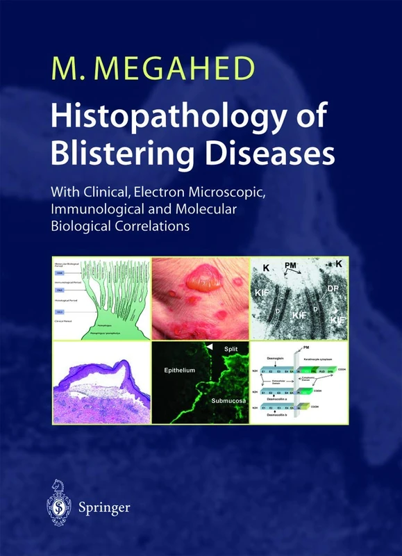 Histopathology of Blistering Diseases: With Clinical, Electron Microscopic, Immunological and Molecular Biological Correlations Textbook and Atlas