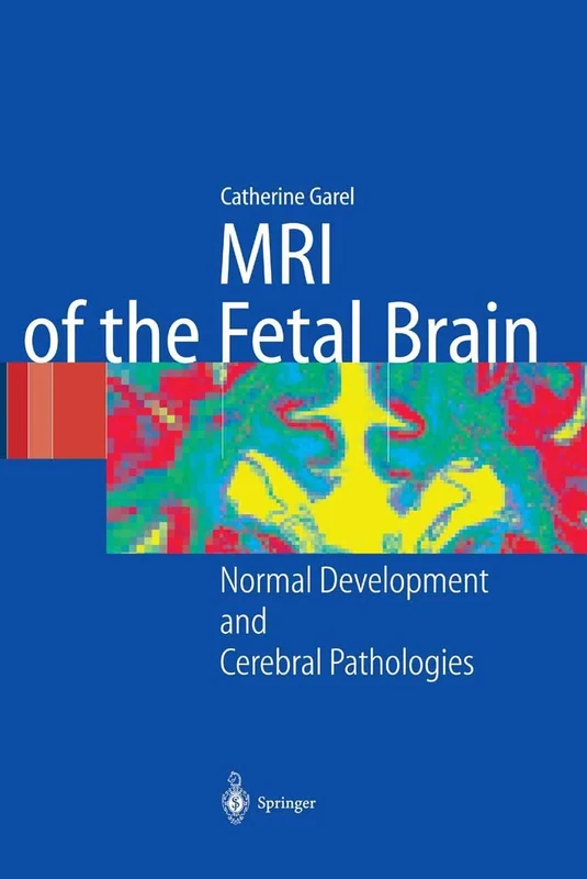 MRI of the Fetal Brain: Normal Development and Cerebral Pathologies