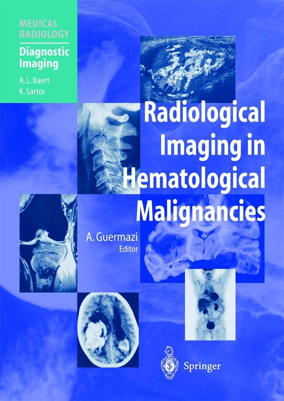 Radiological Imaging in Hematological Malignancies (Medical Radiology)