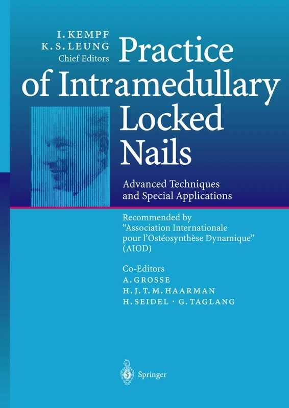 Practice of Intramedullary Locked Nails: Advanced Techniques and Special Applications Recommended by “Association Internationale pour l’Ostéosynthèse Dynamique” (AIOD)