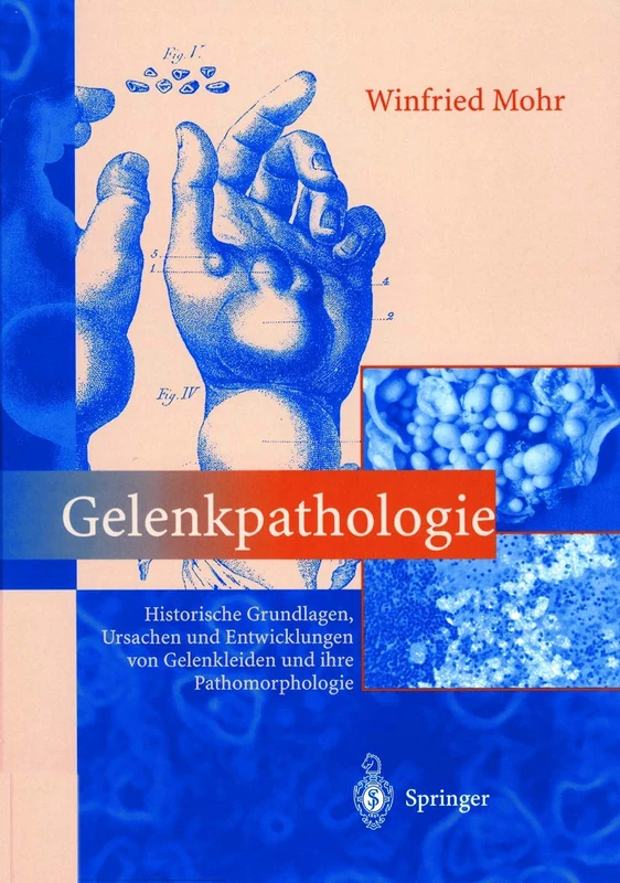 Gelenkpathologie: Historische Grundlagen, Ursachen und Entwicklungen von Gelenkleiden und ihre Pathomorphologie