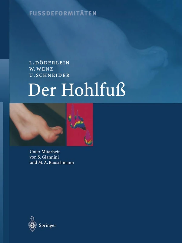 Fussdeformitäten: Der Hohlfuss - Image 1