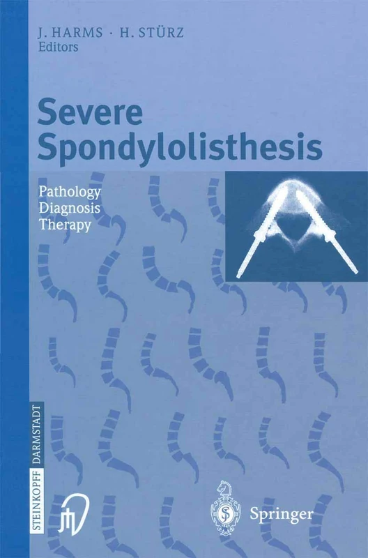 Severe Spondylolisthesis: Pathology - Diagnosis - Therapy