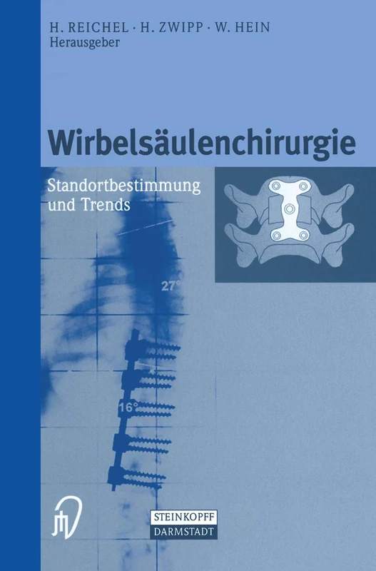 Wirbelsäulenchirurgie: Standortbestimmung und Trends