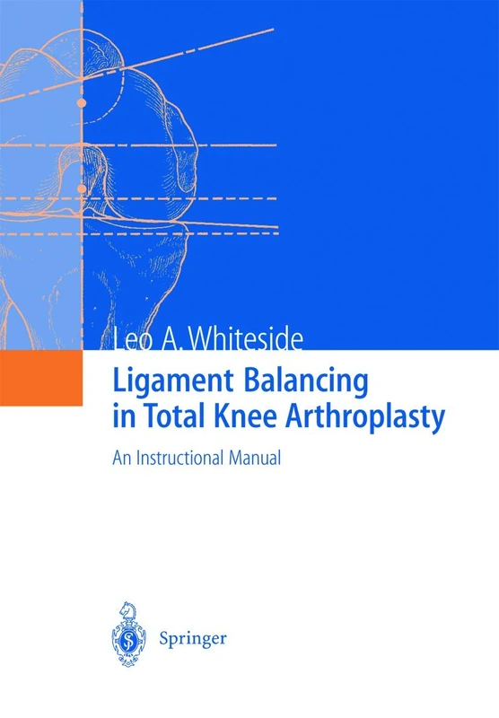 Ligament Balancing in Total Knee Arthroplasty: An Instructional Manual - Image 1