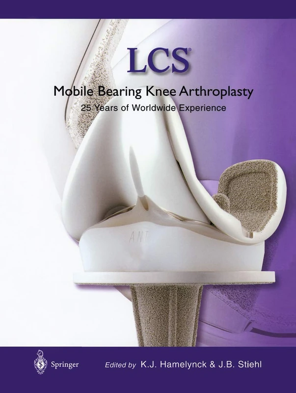 LCS® Mobile Bearing Knee Arthroplasty: A 25 Years Worldwide Review - Image 1