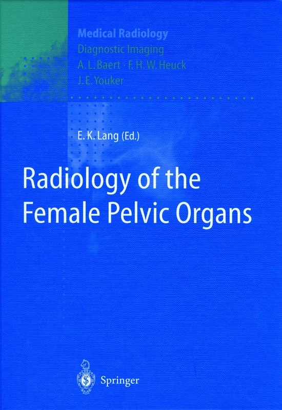 Springer Radiology of the Female Pelvic Organs Book