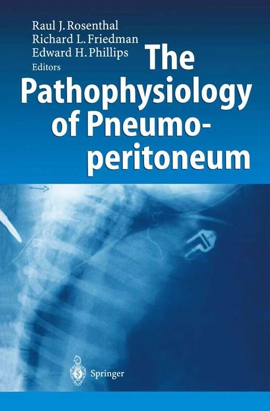 The Pathophysiology of Pneumoperitoneum - Image 1