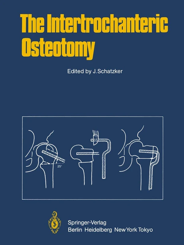 The Intertrochanteric Osteotomy - Image 1
