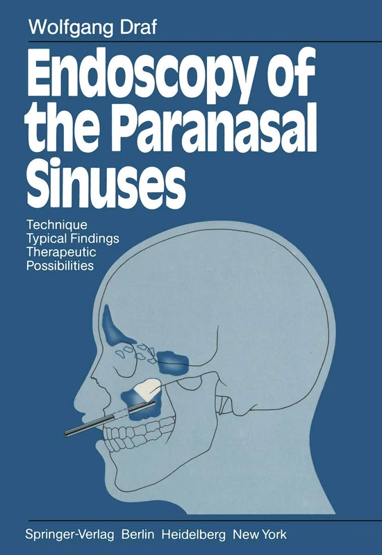 Endoscopy of the Paranasal Sinuses: Technique · Typical Findings Therapeutic Possibilities