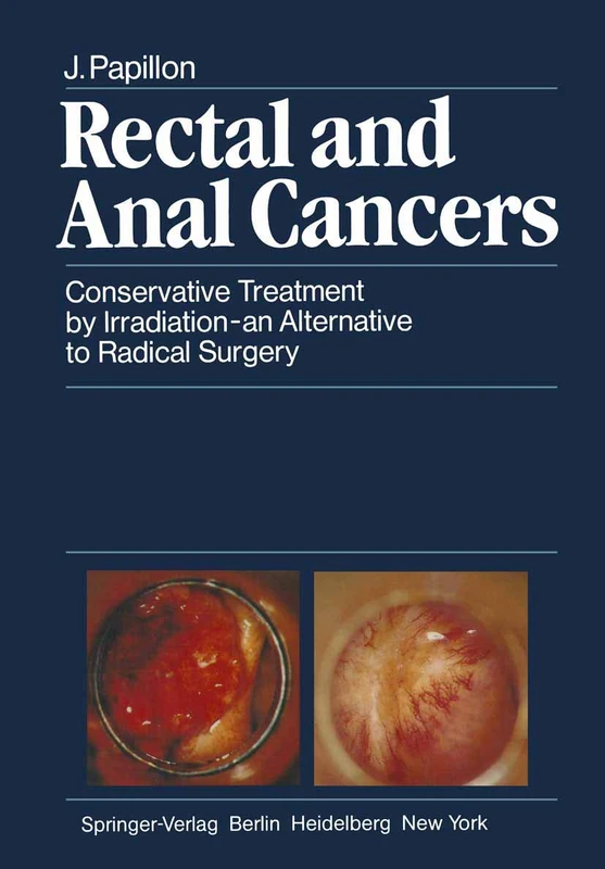 Rectal and Anal Cancers: Conservative Treatment by Irradiation ― an Alternative to Radical Surgery