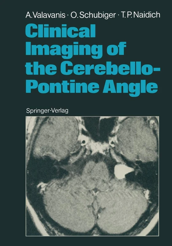 Clinical Imaging of the Cerebello-Pontine Angle - Image 1