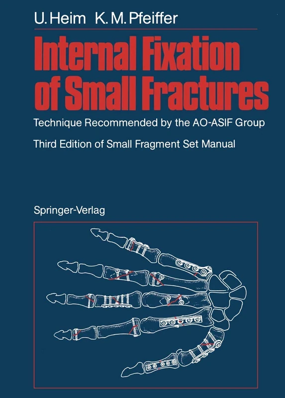 Internal Fixation of Small Fractures: Technique Recommended by the AO-ASIF Group