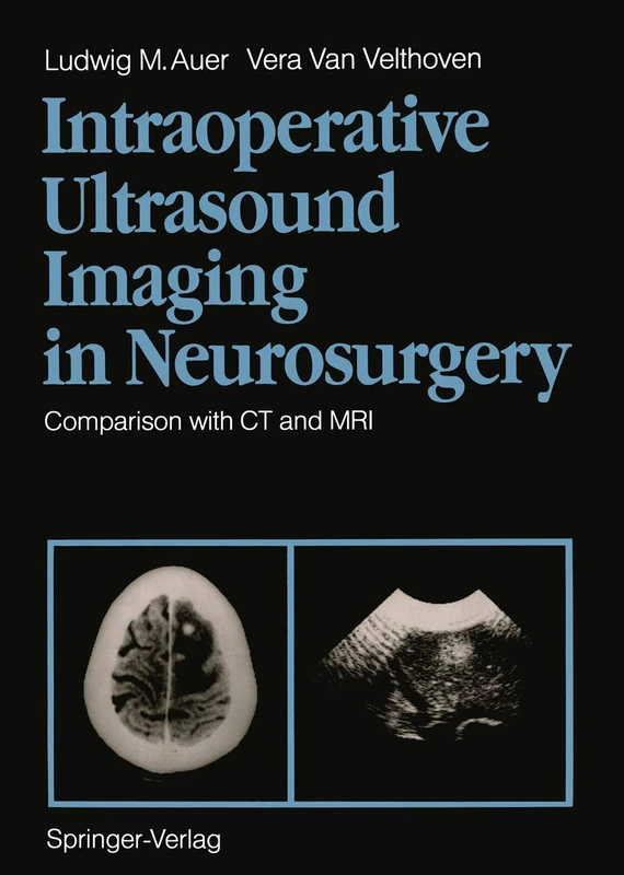 Intraoperative Ultrasound Imaging in Neurosurgery: Comparison with CT and MRI