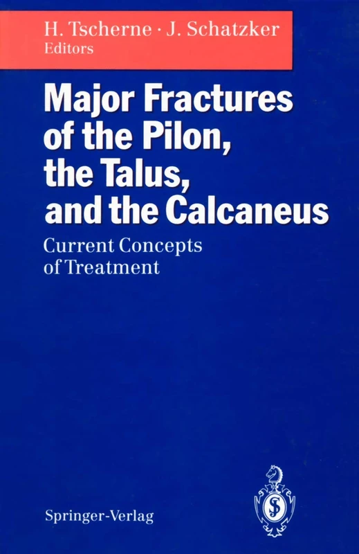 Major Fractures of the Pilon, the Talus, and the Calcaneus: Current Concepts of Treatment - Image 1