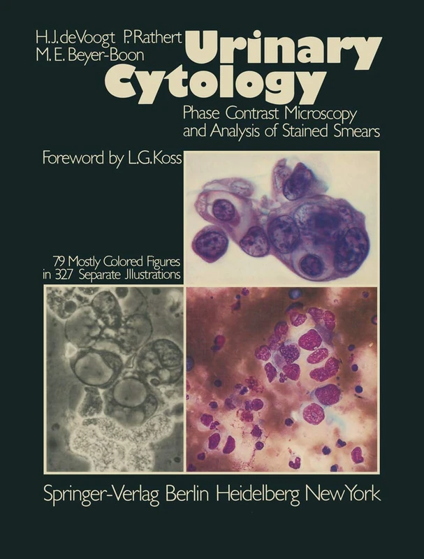 Urinary Cytology: Phase Contrast Microscopy and Analysis of Stained Smears