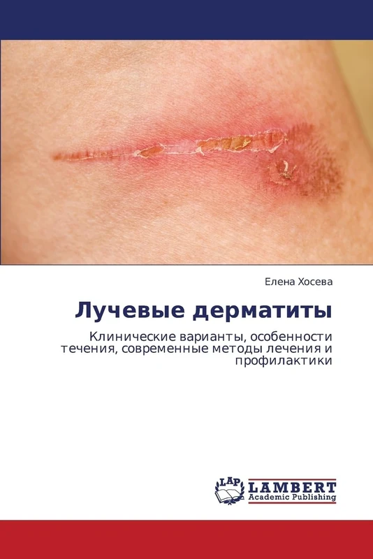 Luchevye dermatity: Klinicheskie varianty, osobennosti techeniya, sovremennye metody lecheniya i profilaktiki - Image 1