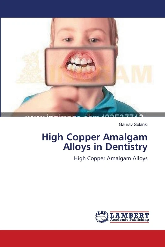 High Copper Amalgam Alloys in Dentistry: High Copper Amalgam Alloys