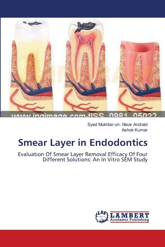 Smear Layer in Endodontics: Evaluation Of Smear Layer Removal Efficacy Of Four Different Solutions: An In Vitro SEM Study