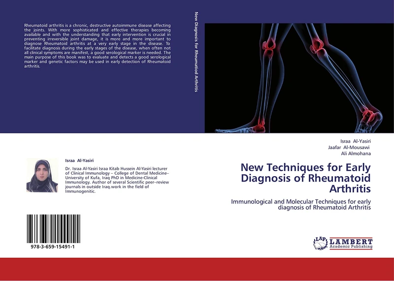 New Techniques for Early Diagnosis of Rheumatoid Arthritis: Immunological and Molecular Techniques for early diagnosis of Rheumatoid Arthritis