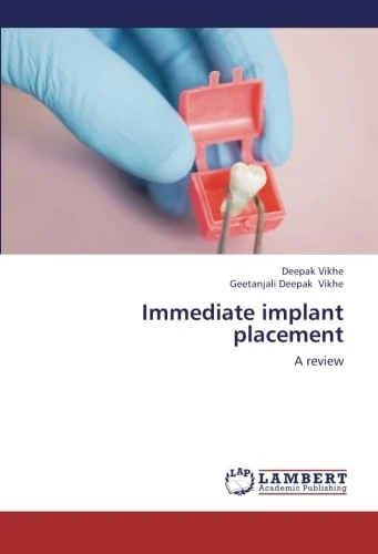 Immediate implant placement: A review