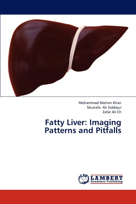 Fatty Liver: Imaging Patterns and Pitfalls - Image 1