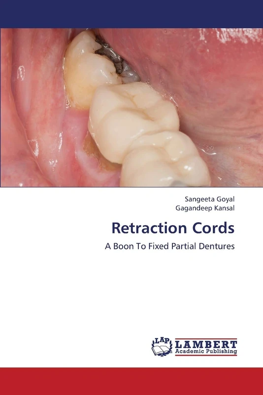 Retraction Cords: A Boon To Fixed Partial Dentures - Image 1