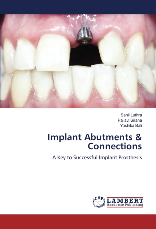 Implant Abutments & Connections: A Key to Successful Implant Prosthesis - Image 1