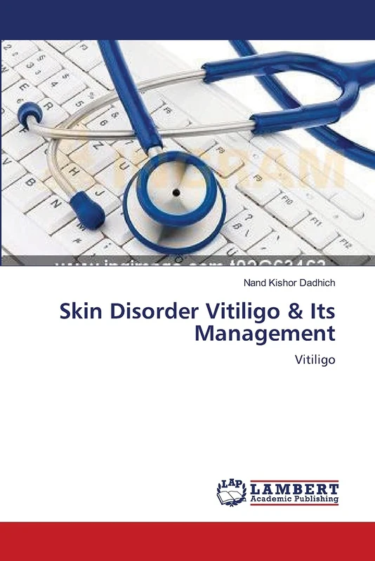 Skin Disorder Vitiligo & Its Management: Vitiligo